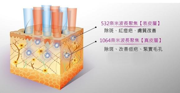 祛痘我用點(diǎn)陣，你呢？！