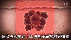 皮秒激光儀器的一些問題的解答！