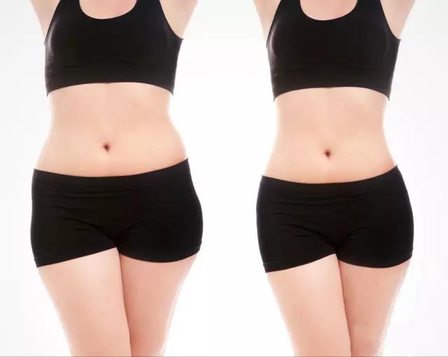 UltraShape優(yōu)立塑非侵入式專利科技、有效、安全！